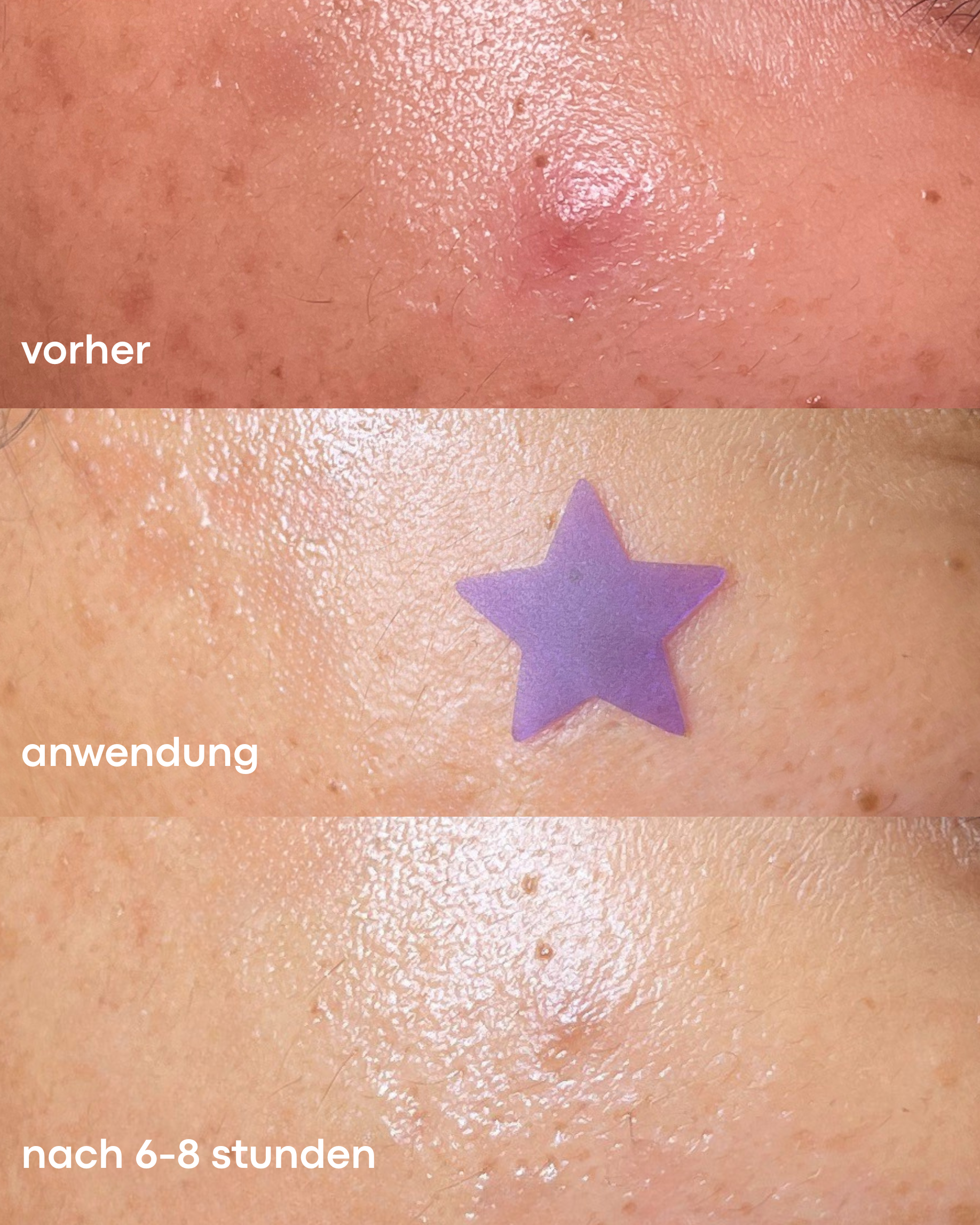 DAY & NIGHT PICKEL PATCHES