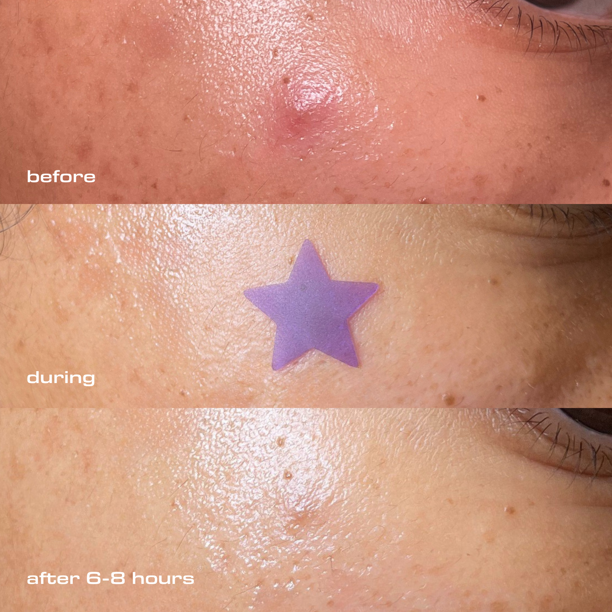 Pickel Patches DAY & NIGHT