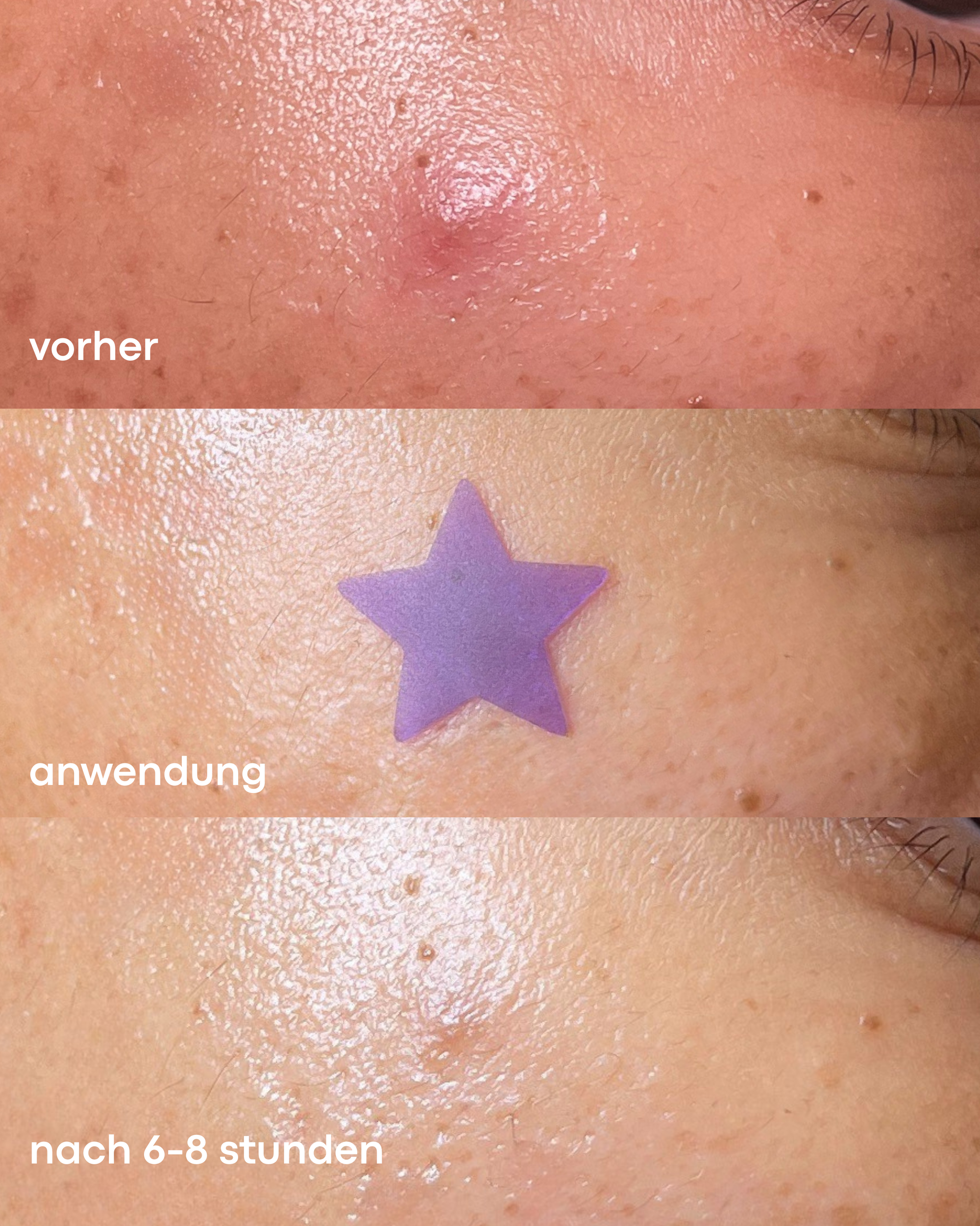 DAY & NIGHT PICKEL PATCHES