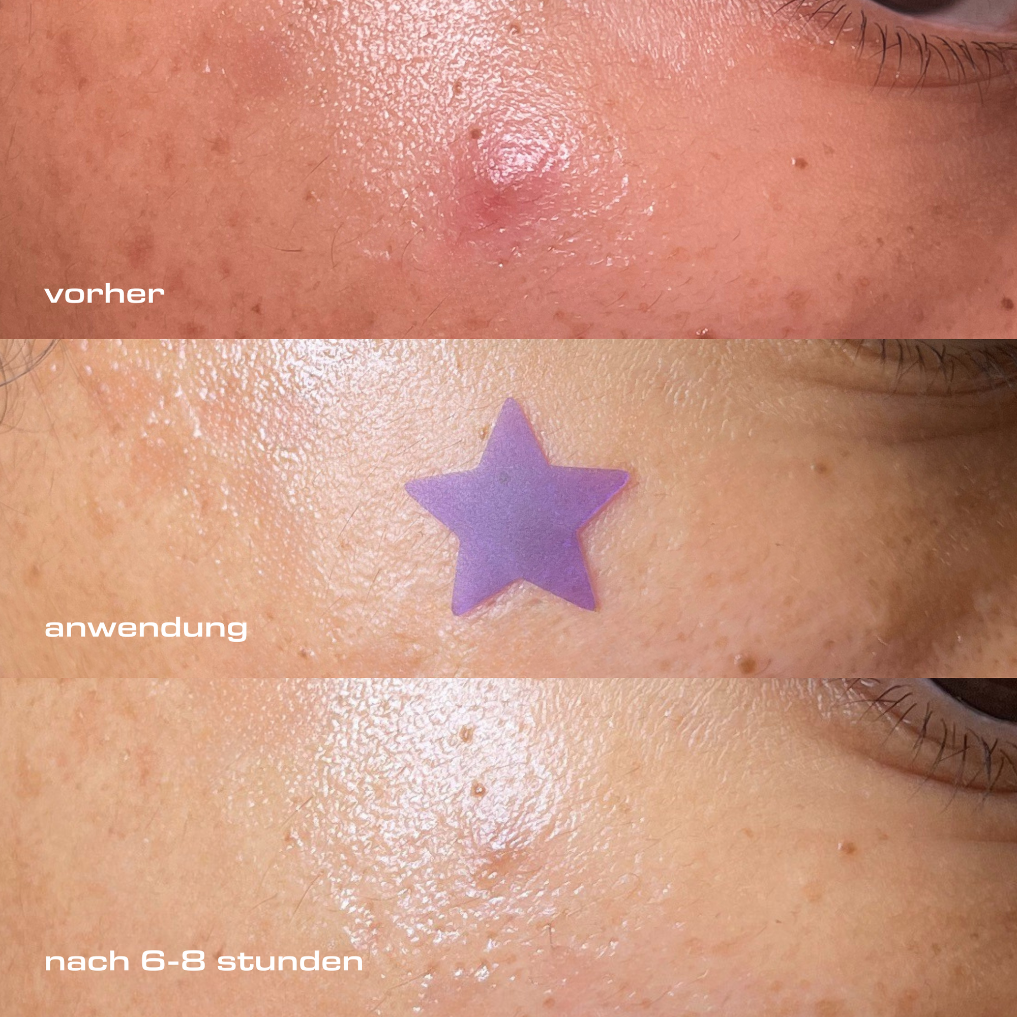 Pickel Patches DAY & NIGHT